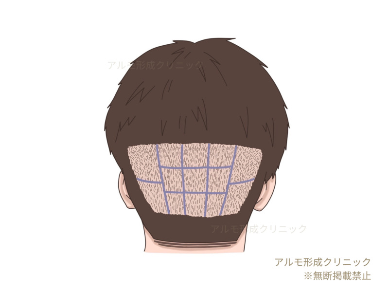 区分け後のイラスト