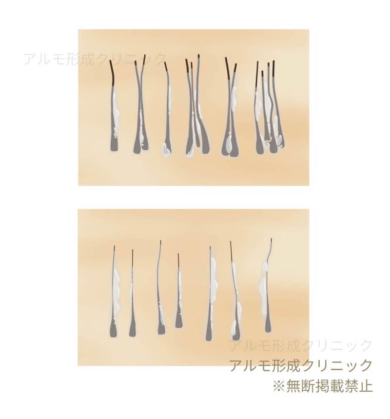 太さや種類で選別後のイラスト