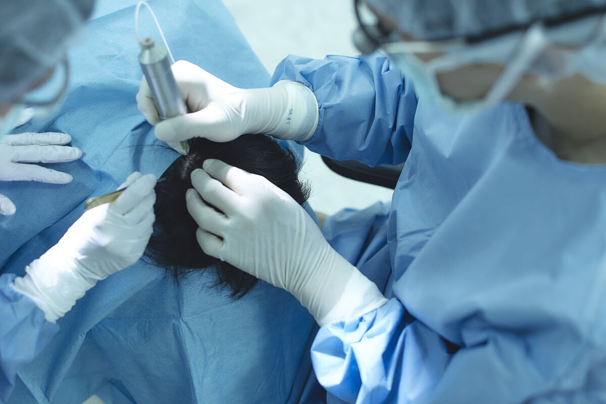 刈り上げないからバレにくいUnshaven法