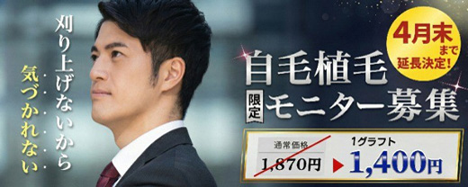 自毛植毛｜顔出し動画モニター募集のお知らせ