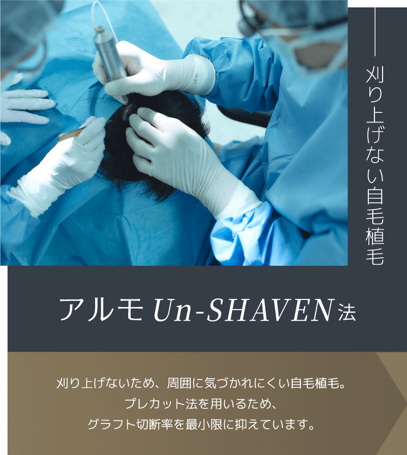 【アルモUn-SHAVEN法】刈り上げないため、周囲に気づかれにくい自毛植毛。プレカット法を用いるため、グラフト切断率を最小限に抑えています。