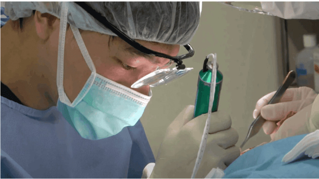 植毛クリニックの機械の違いとは？①