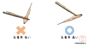 植毛看護師の実力と教育｜東京 自毛植毛 アルモ形成クリニック 美容外科