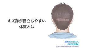キズ跡が目立ちやすい体質とは｜東京 自毛植毛 アルモ形成クリニック 美容外科