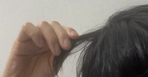 抜け毛を自分で把握する｜東京 自毛植毛 アルモ形成クリニック 美容外科