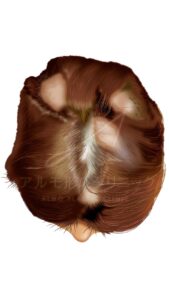 円形脱毛症と自毛植毛について｜東京 自毛植毛 アルモ形成クリニック 美容外科