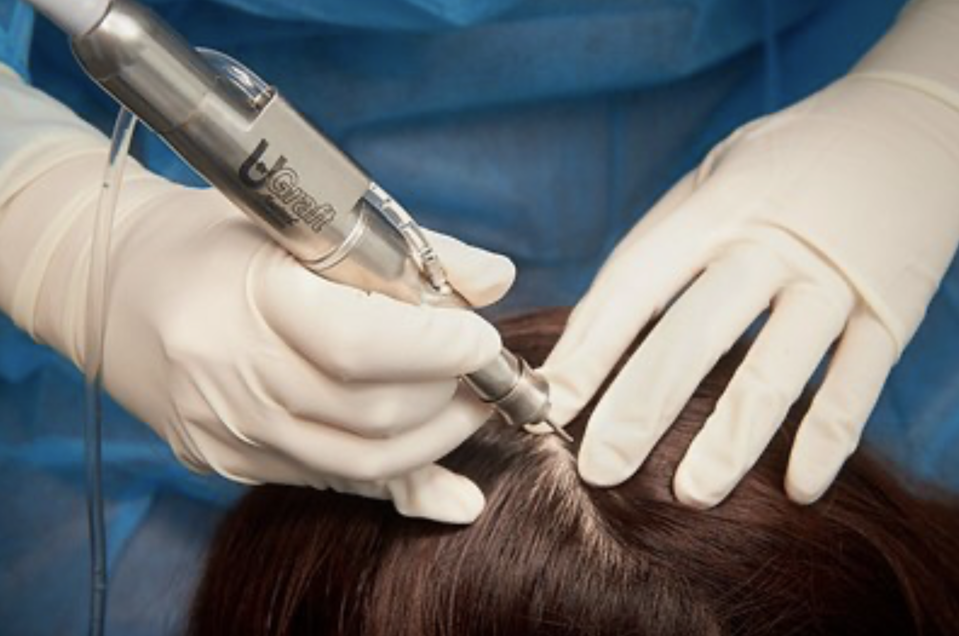 Dr Umarの教え｜東京 自毛植毛 アルモ形成クリニック 美容外科