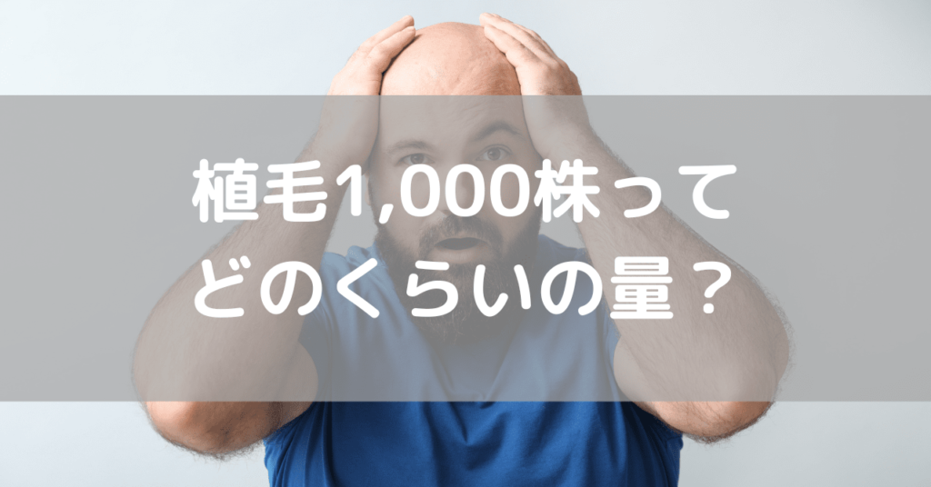 植毛1000株でどこまで薄毛が改善する？費用・範囲・満足度を解説