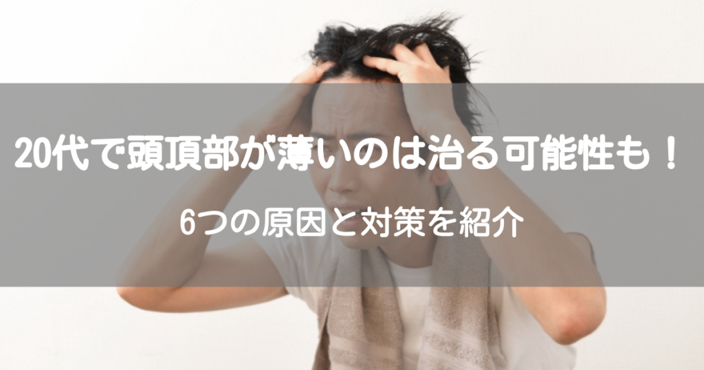 20代で頭頂部が薄いのは治る可能性も！6つの原因と対策を紹介