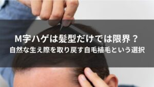 M字ハゲは髪型だけでは限界？自然な生え際を取り戻す自毛植毛という選択