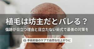 植毛は坊主だとバレる？傷跡が目立つ理由と目立たない術式で最善の対策を