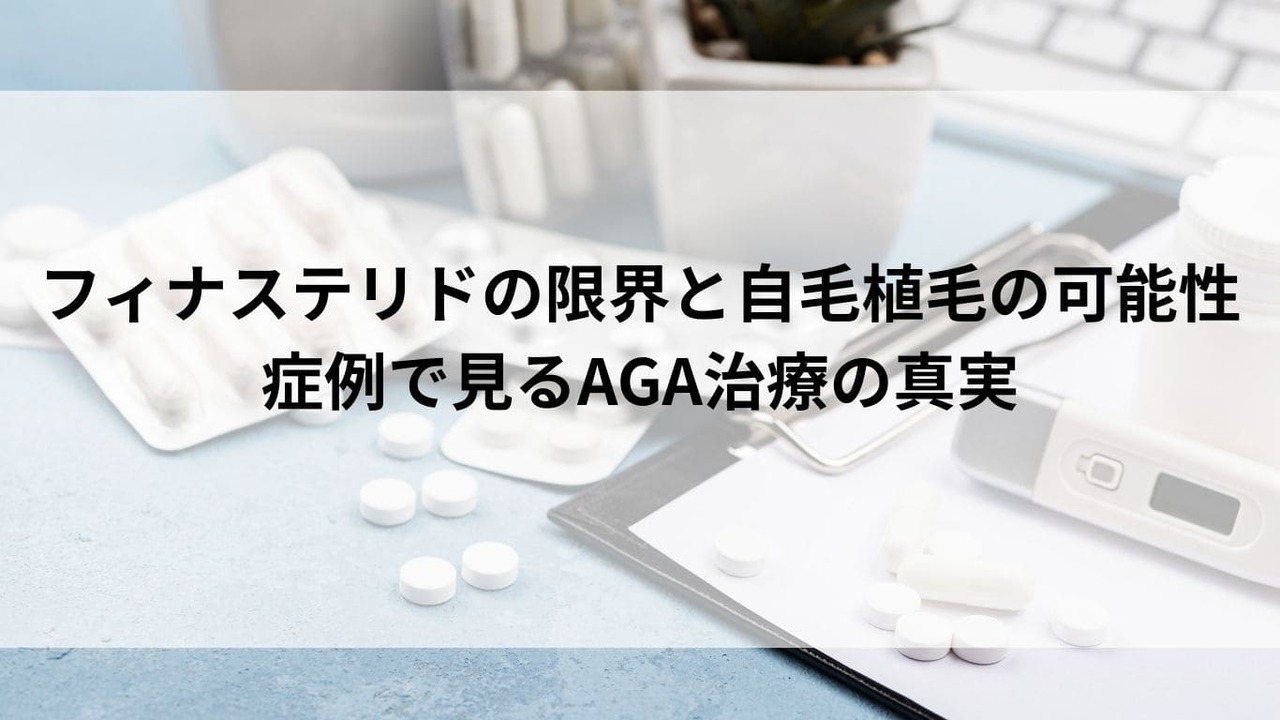 フィナステリドの限界と自毛植毛の可能性｜症例で見るAGA治療の真実