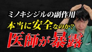 【医師が暴露】9割が知らない「ミノキシジル副作用」の真実とは？2025年最新データで徹底解説！