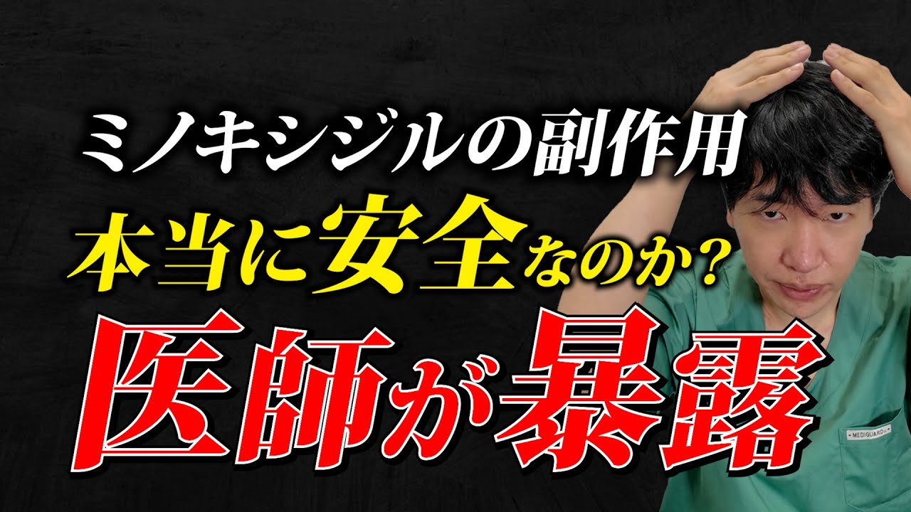 【医師が暴露】9割が知らない「ミノキシジル副作用」の真実とは？2025年最新データで徹底解説！