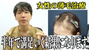 【薄毛治療】女性の薄毛治療を解説！生え際の治療法を教えます