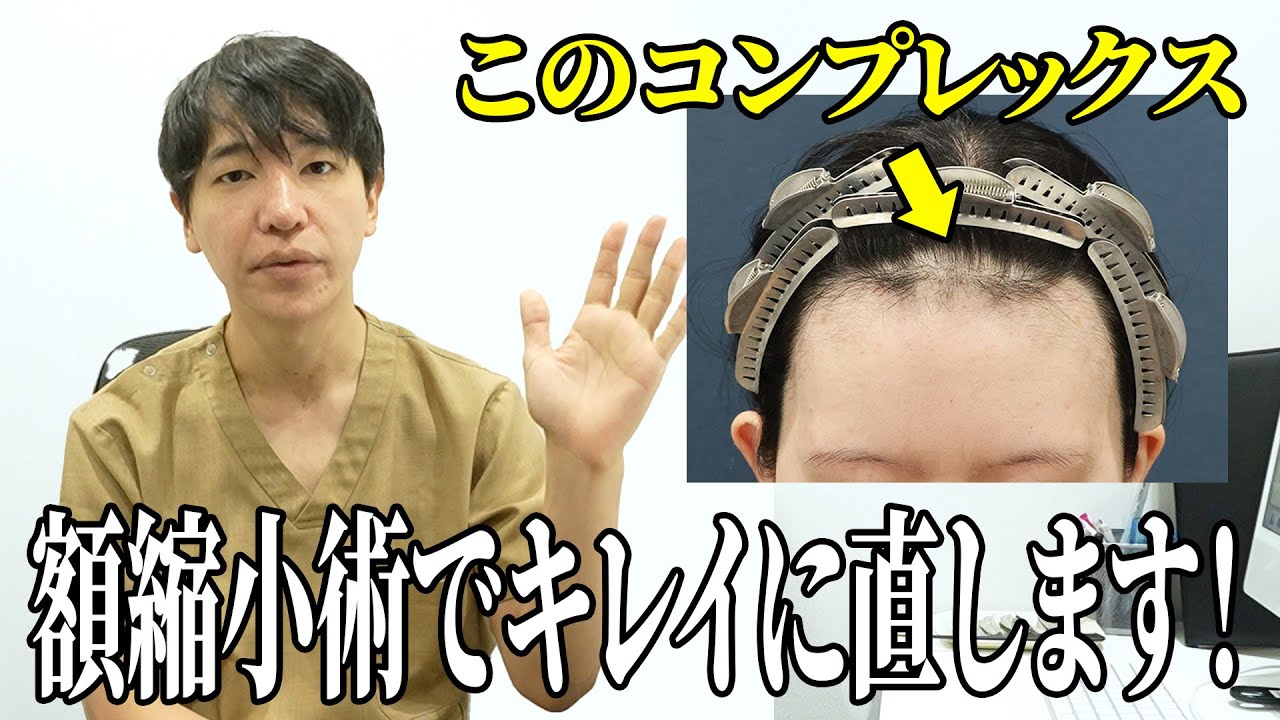 【悩み解決】長年のコンプレックスを解消！手術の全貌をお話します！！