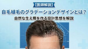 【医師解説】自毛植毛のグラデーションデザインとは？自然な生え際を作る設計思想を解説