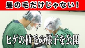 【植毛手術】M字やAGAだけじゃない！ヒゲの植毛手術をお見せします！！