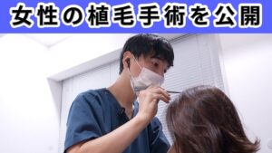 【AGA】女性も薄毛に悩む！植毛の手術と途中経過を報告します！！